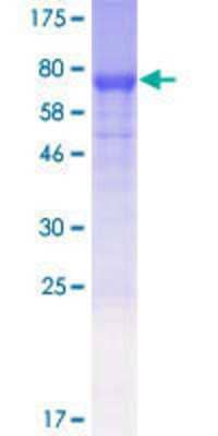 12.5% SDS-PAGE Stained with Coomassie Blue.