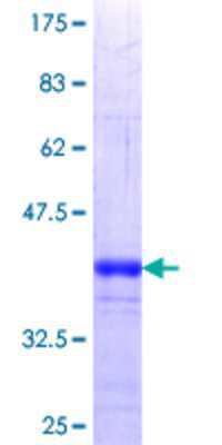 12.5% SDS-PAGE Stained with Coomassie Blue.