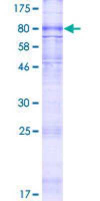 12.5% SDS-PAGE Stained with Coomassie Blue.