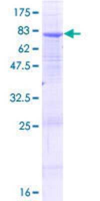 Other Recombinant Human ALG2 GST (N-Term) Protein