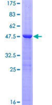 SDS-PAGE Recombinant Human RGS8 GST (N-Term) Protein