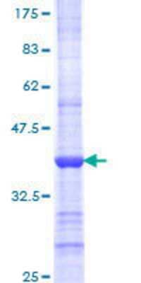 12.5% SDS-PAGE Stained with Coomassie Blue.