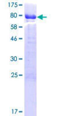 SDS-PAGE Recombinant Human CABS1 GST (N-Term) Protein