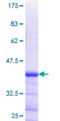 12.5% SDS-PAGE Stained with Coomassie Blue.
