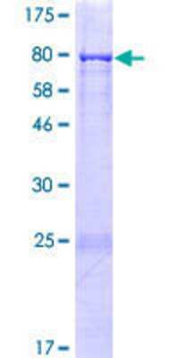 12.5% SDS-PAGE Stained with Coomassie Blue.