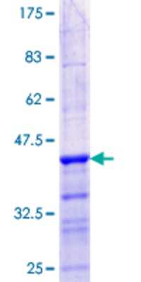12.5% SDS-PAGE Stained with Coomassie Blue.