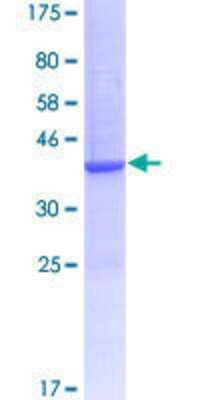 12.5% SDS-PAGE Stained with Coomassie Blue.