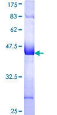 12.5% SDS-PAGE Stained with Coomassie Blue.