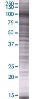 NAV2 transfected lysate.