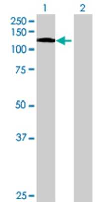 Lane 1: NAV2 transfected lysate (96.14 KDa) Lane 2: Non-transfected lysate.