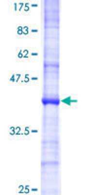 12.5% SDS-PAGE Stained with Coomassie Blue.