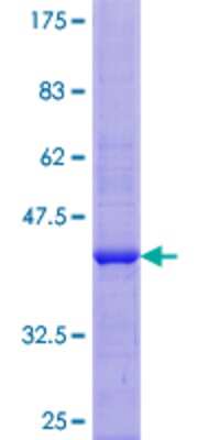 12.5% SDS-PAGE Stained with Coomassie Blue.