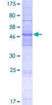 12.5% SDS-PAGE Stained with Coomassie Blue.