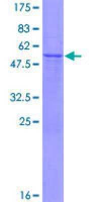 12.5% SDS-PAGE Stained with Coomassie Blue.