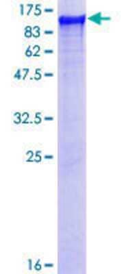 12.5% SDS-PAGE Stained with Coomassie Blue.