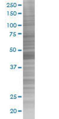 SPSB3 transfected lysate.