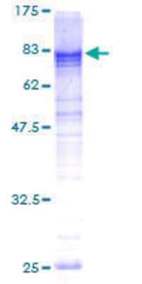 12.5% SDS-PAGE Stained with Coomassie Blue.