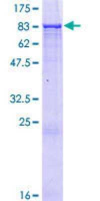 12.5% SDS-PAGE Stained with Coomassie Blue.