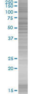 ZNF502 transfected lysate.