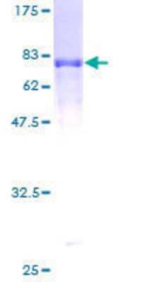 12.5% SDS-PAGE Stained with Coomassie Blue.