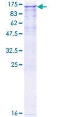 Other Recombinant Human NEK9 GST (N-Term) Protein