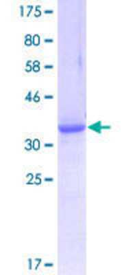 SDS-Page: Recombinant Human NEK9 Protein [H00091754-Q01] - 12.5% SDS-PAGE Stained with Coomassie Blue.