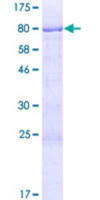 Other Recombinant Human CHMP7 GST (N-Term) Protein