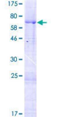 12.5% SDS-PAGE Stained with Coomassie Blue.