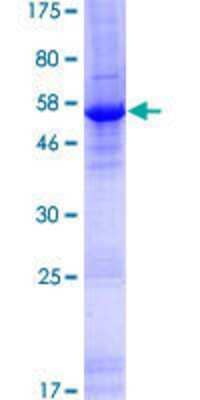 12.5% SDS-PAGE Stained with Coomassie Blue.