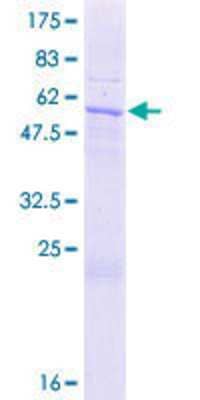 12.5% SDS-PAGE Stained with Coomassie Blue.