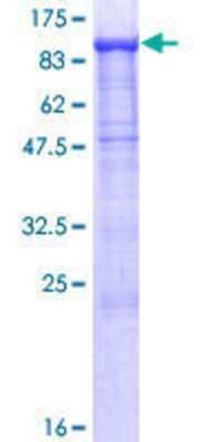 12.5% SDS-PAGE Stained with Coomassie Blue.