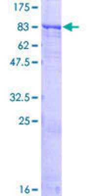 12.5% SDS-PAGE Stained with Coomassie Blue.