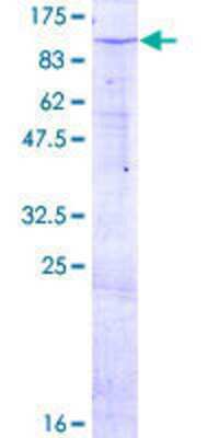 Other Recombinant Human ZNF585B GST (N-Term) Protein