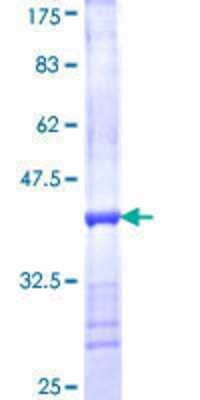 12.5% SDS-PAGE Stained with Coomassie Blue.