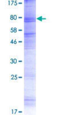 Other Recombinant Human OTOP2 GST (N-Term) Protein