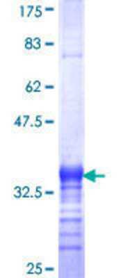12.5% SDS-PAGE Stained with Coomassie Blue.