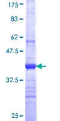 SDS-Page: Recombinant Human PKHD1L1 Protein [H00093035-Q01] - 12.5% SDS-PAGE Stained with Coomassie Blue.