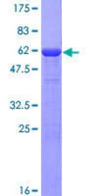 12.5% SDS-PAGE Stained with Coomassie Blue.