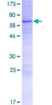 12.5% SDS-PAGE Stained with Coomassie Blue.