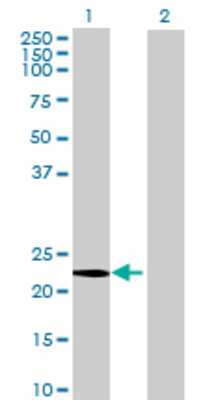 Lane 1: CGB5 transfected lysate (18.26 KDa) Lane 2: Non-transfected lysate.
