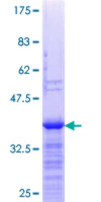 SDS-Page: Recombinant Human ZNF101 Protein [H00094039-Q01] - 12.5% SDS-PAGE Stained with Coomassie Blue.