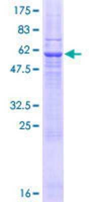 12.5% SDS-PAGE Stained with Coomassie Blue.