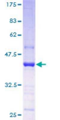 12.5% SDS-PAGE Stained with Coomassie Blue.