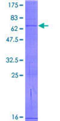 12.5% SDS-PAGE Stained with Coomassie Blue.