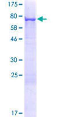 SDS-PAGE Recombinant Human Cytokeratin 71 GST (N-Term) Protein