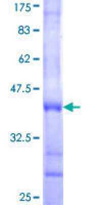 12.5% SDS-PAGE Stained with Coomassie Blue.