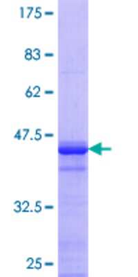 12.5% SDS-PAGE Stained with Coomassie Blue.