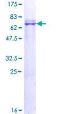 12.5% SDS-PAGE Stained with Coomassie Blue.