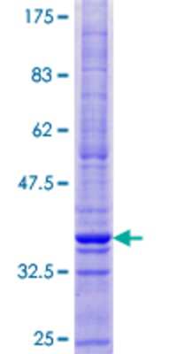 Other Recombinant Human CMTM1 GST (N-Term) Protein