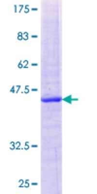 Other Recombinant Human CYP2U1 GST (N-Term) Protein